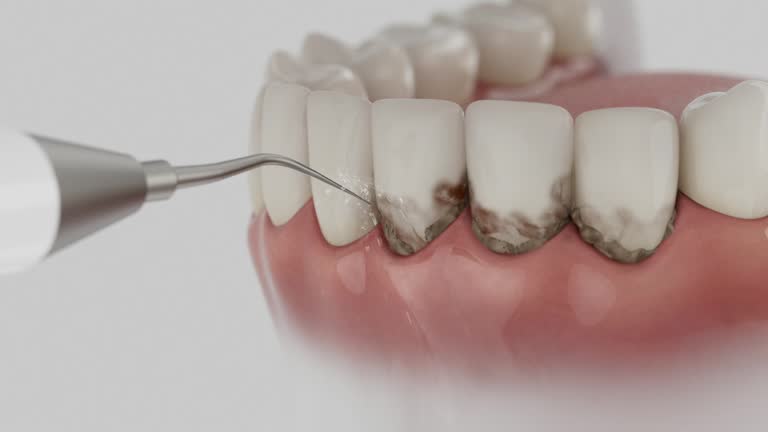 Reliable Emergency Dentist contractor in Framingham, MA by Smile Center Dentistry